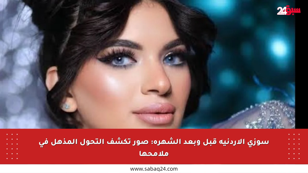 سوزي الأردنية قبل وبعد الشهرة: صور تكشف التحول المذهل في ملامحها